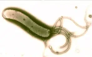 Hlycobacter Pylori